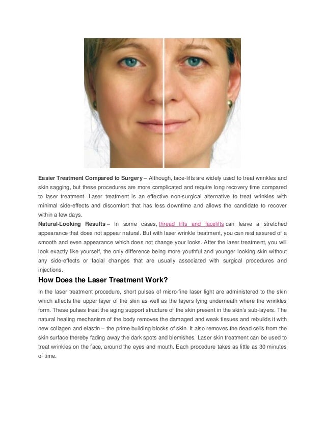 laser treatment for skin blemishes